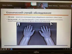 На научно-практической конференции в КБГУ обсудили диагностику и лечение орфанных заболеваний